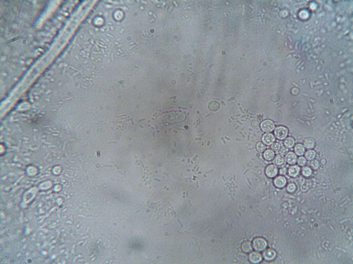 bacteria in water